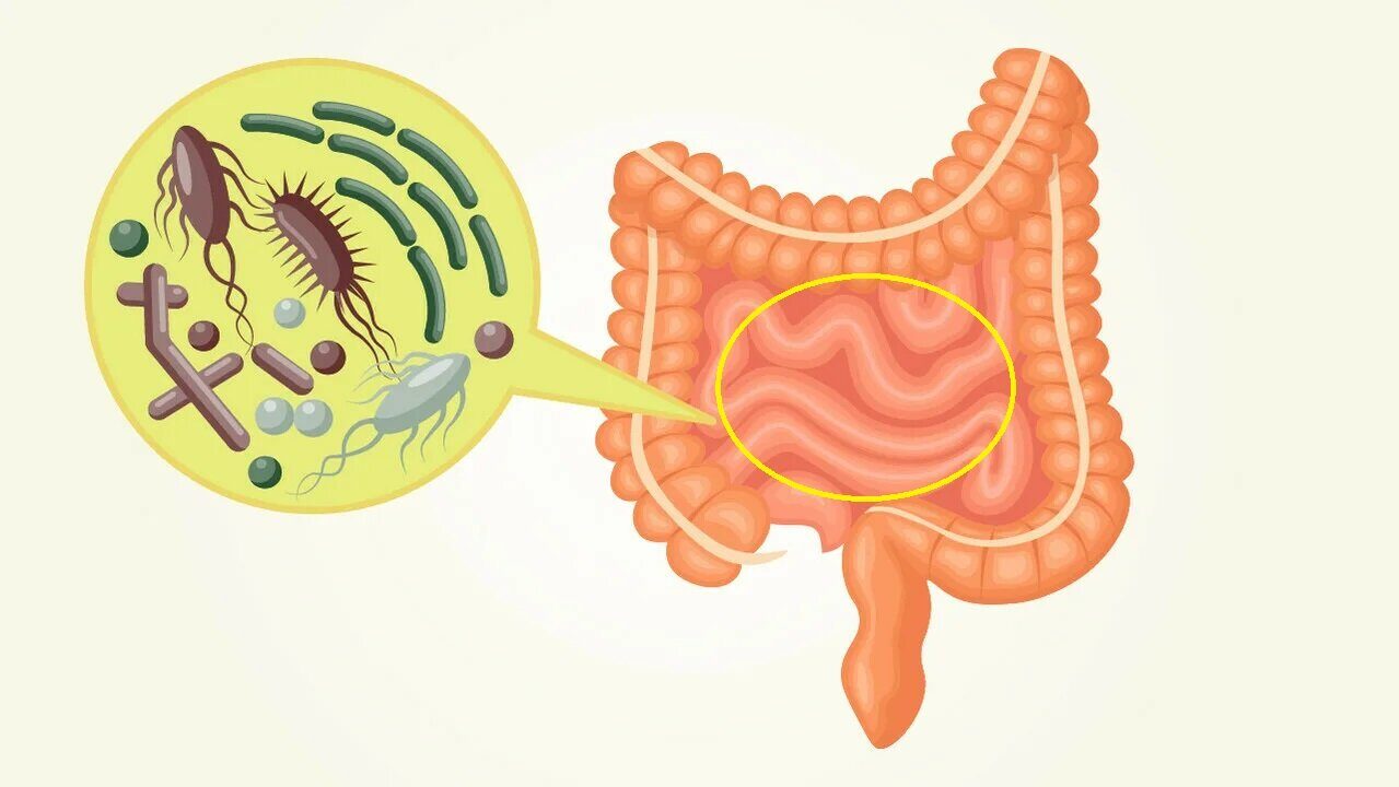 МИКРОБИОТА ТОНКОГО КИШЕЧНИКА